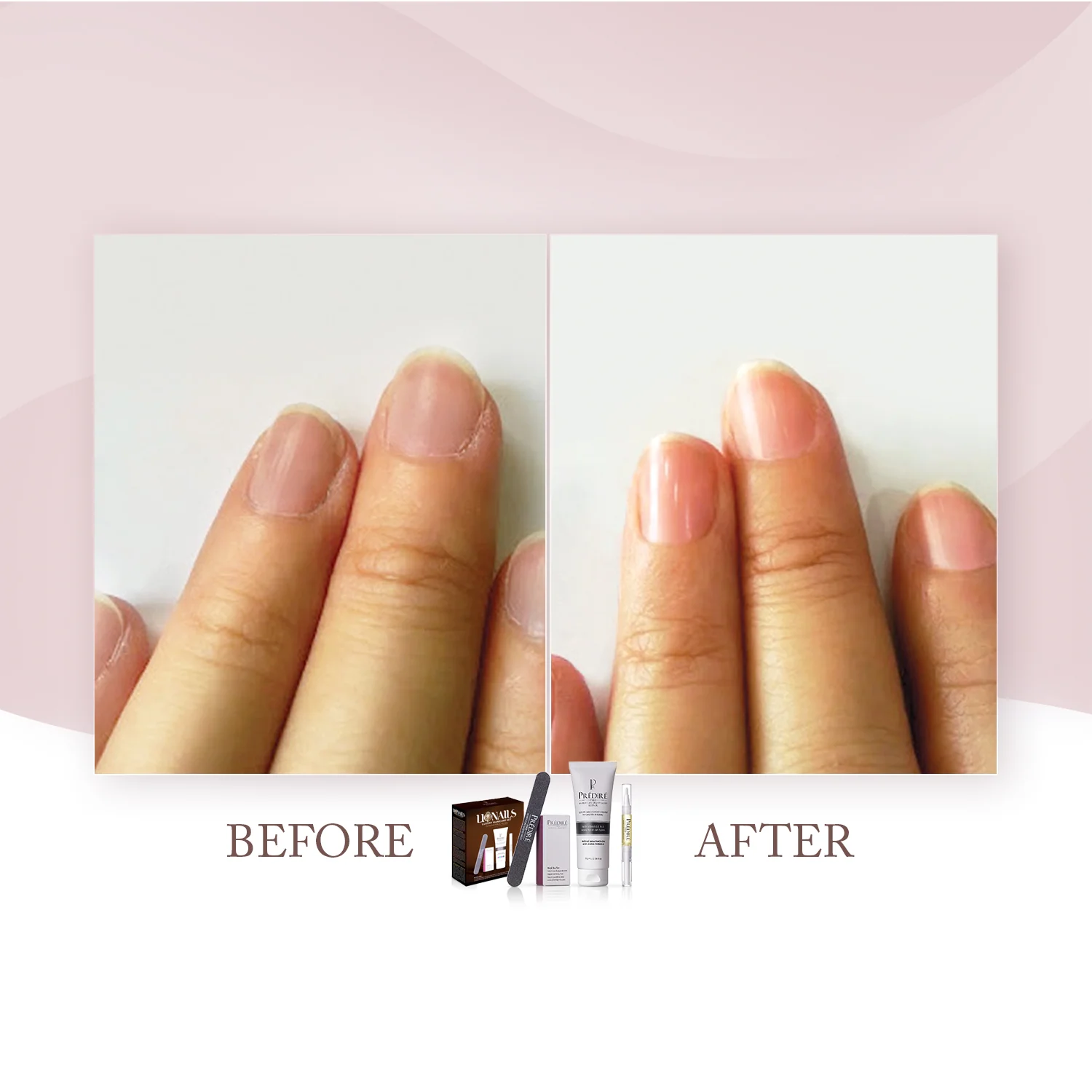 Lionails Luxury Manicure Set | Almond Milk and Honey 4-Piece Set - Image 4