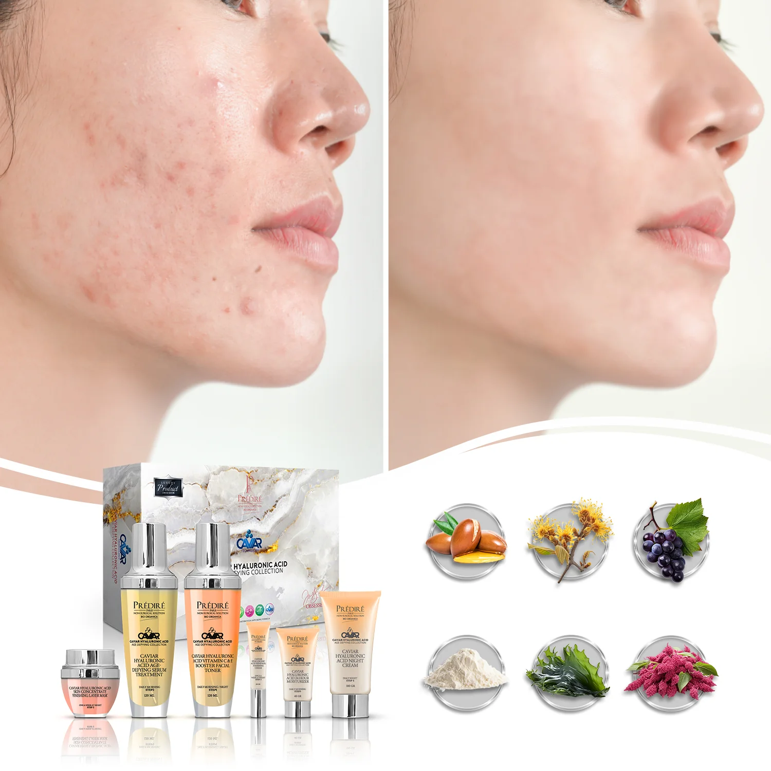 Caviar Hyaluronic Acid Age-Defying Collection | Renew, Moisturize, Cream, Serum, Mask & Toner | Limited Edition - Image 4