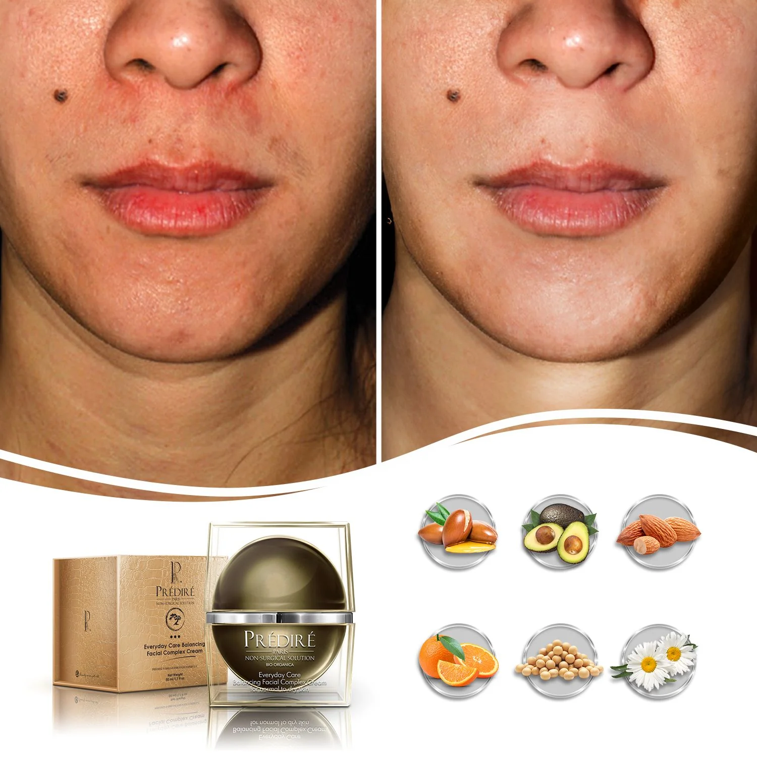 Everyday Care Balancing Facial Complex Cream (Vitamin E & A Booster) - Image 5