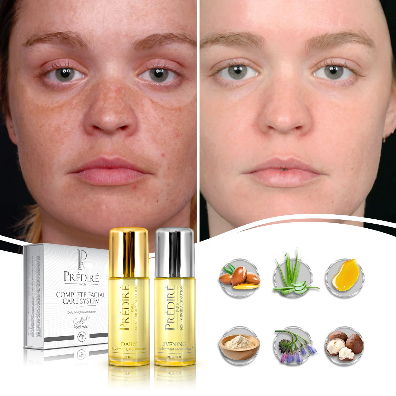 Daily & Nightly Luxury Moisturizing Set, Bundle Complete Facial Care System - Image 4