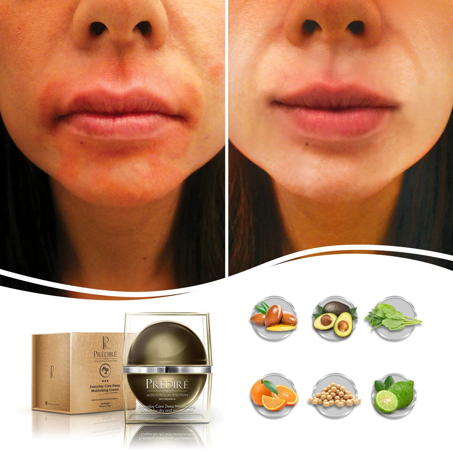 Everyday Care Balancing Facial Complex Cream For Normal to Dry Skin (Vitamin E & A Booster) - Image 5