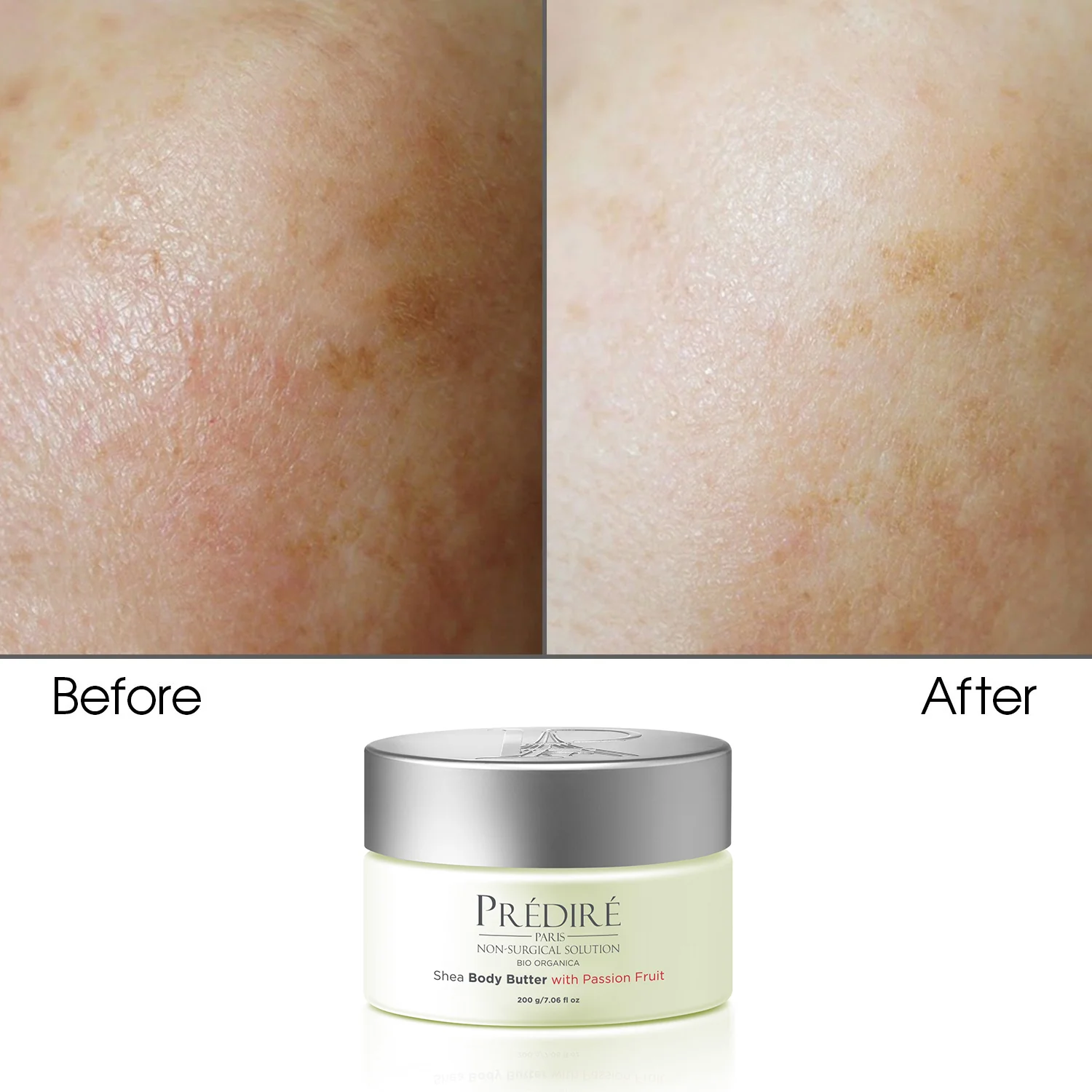 Luxury Body Butter Set - Image 4