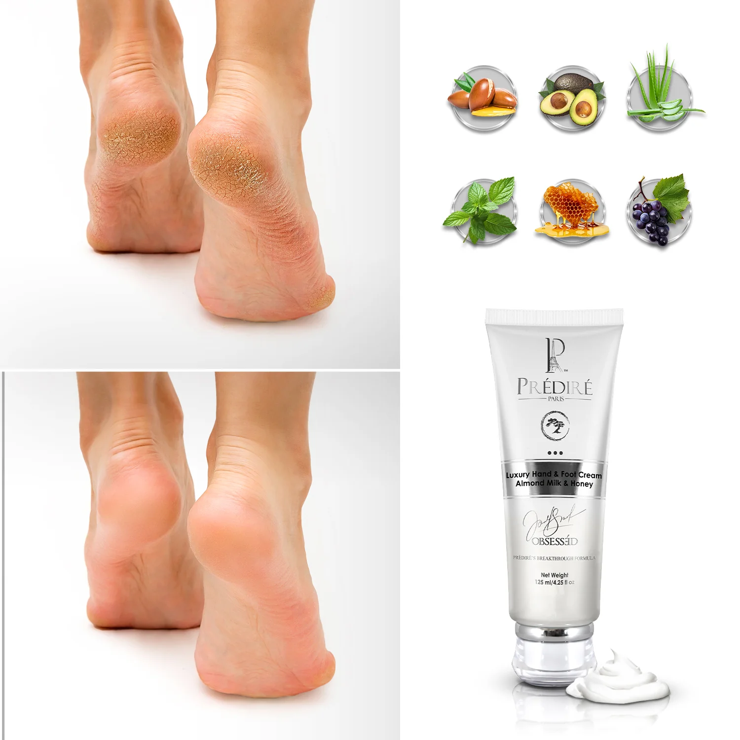 Intensive Foot & Hand Cream for Dry Skin & Rough Skin (Rich with Vitamin E) - Image 3
