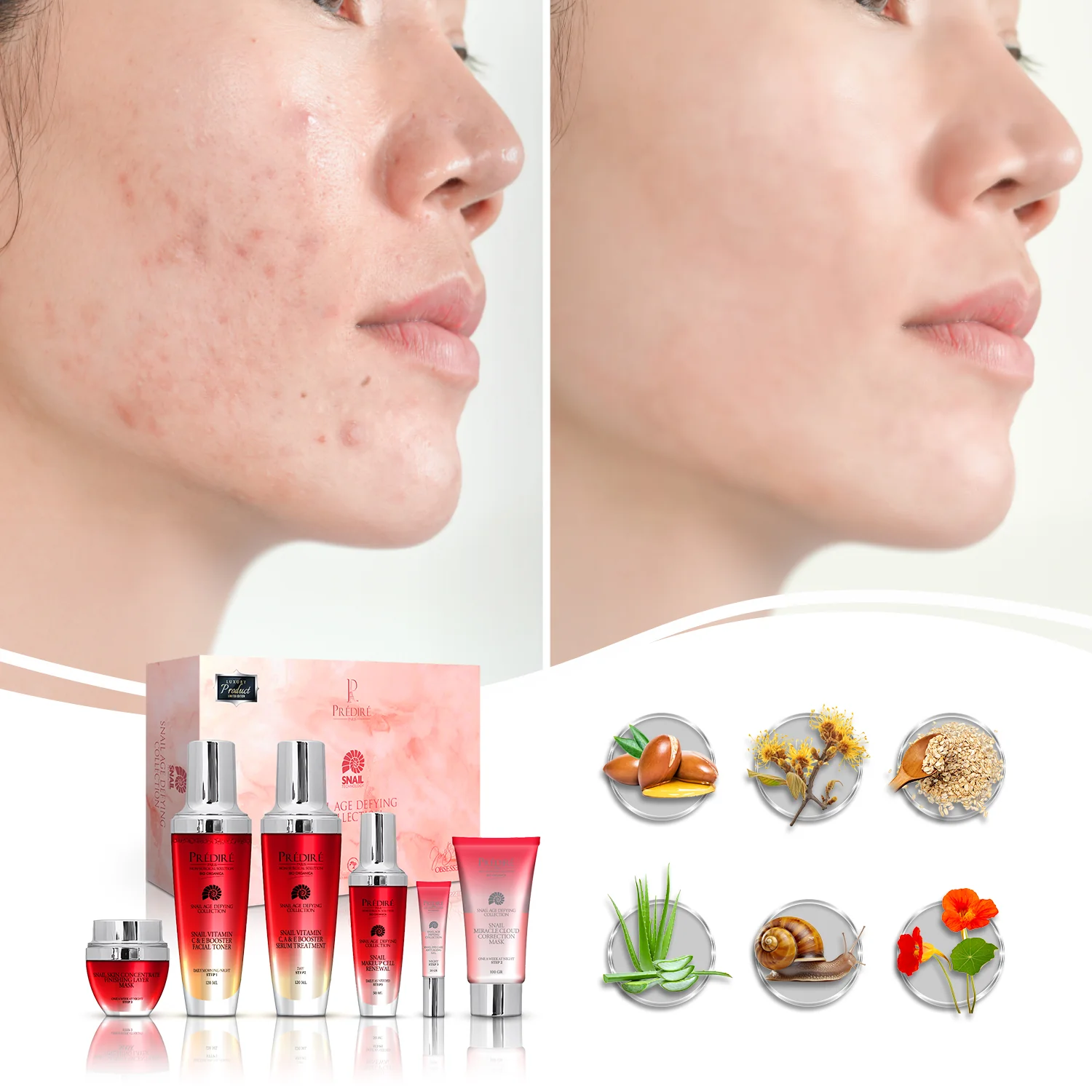 Snail Age-Defying Collection | Concentrate, Serum, Gel, Renewal, Mask, & Toner  | Limited Edition - Image 4