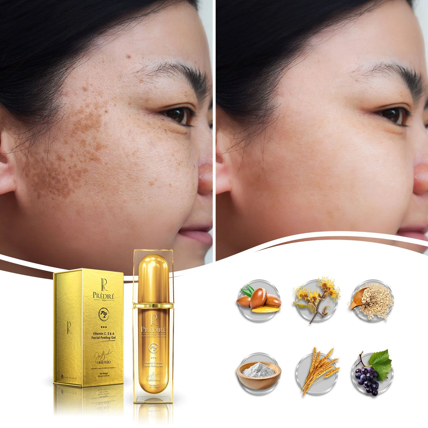 Vitamin C, E & A Booster Facial Peeling Gel, 50ml - Image 3